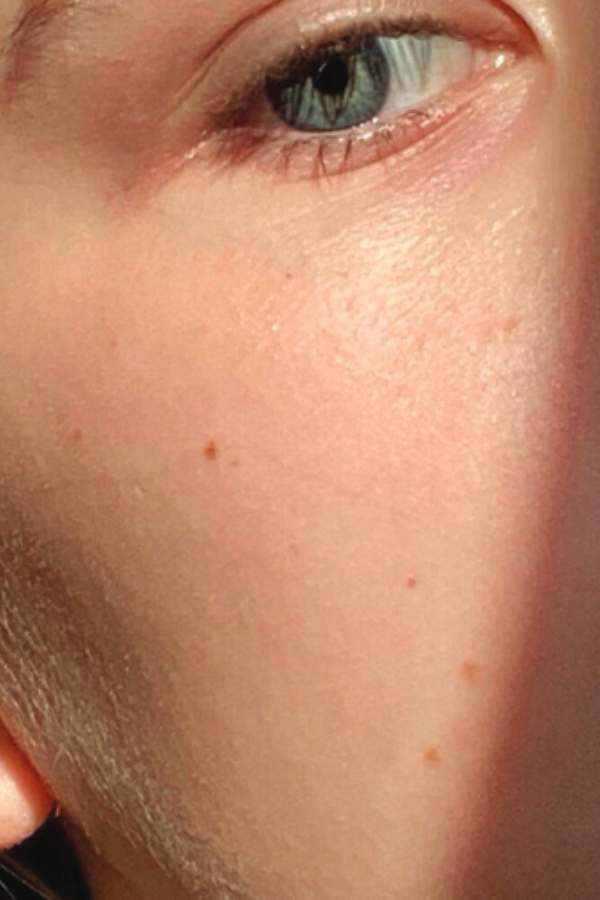 After